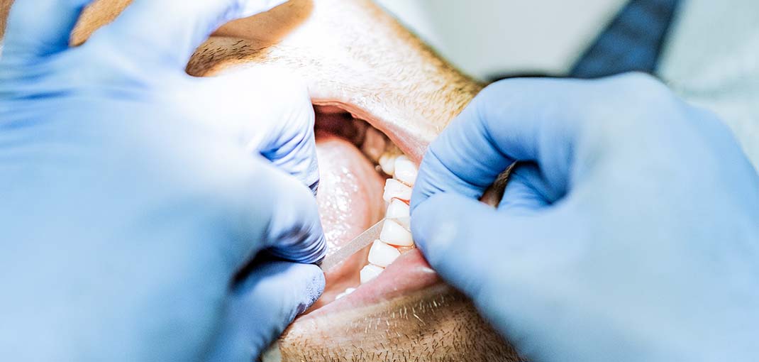 Dental testing