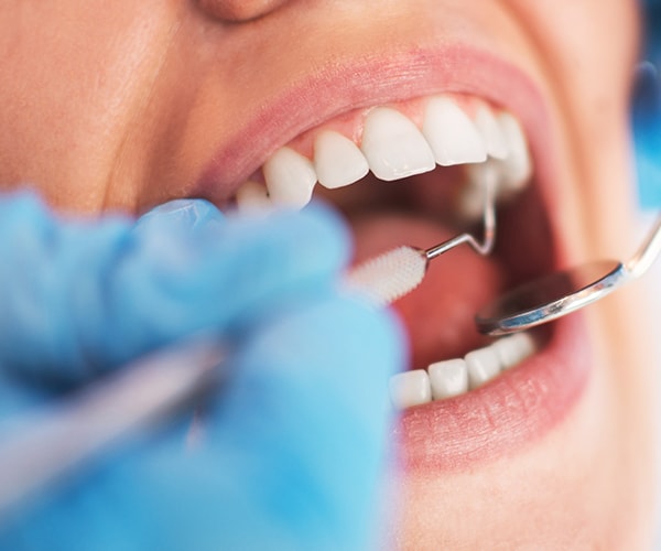 Texture Analysis in Research: Dentistry