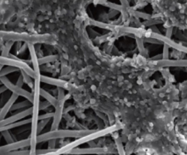 Cartilage scaffold